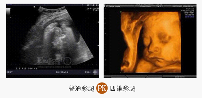 妇科检查要做哪些项目