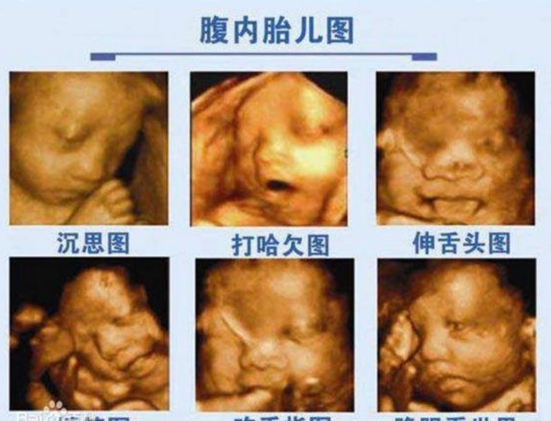 了解妇科健康，从这些基本检查开始