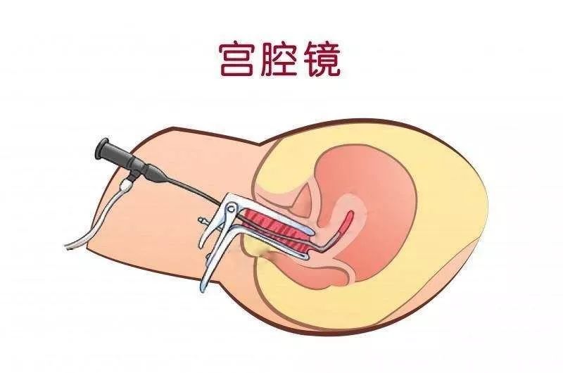 计划生育政策对家庭生活有怎样的影响？
